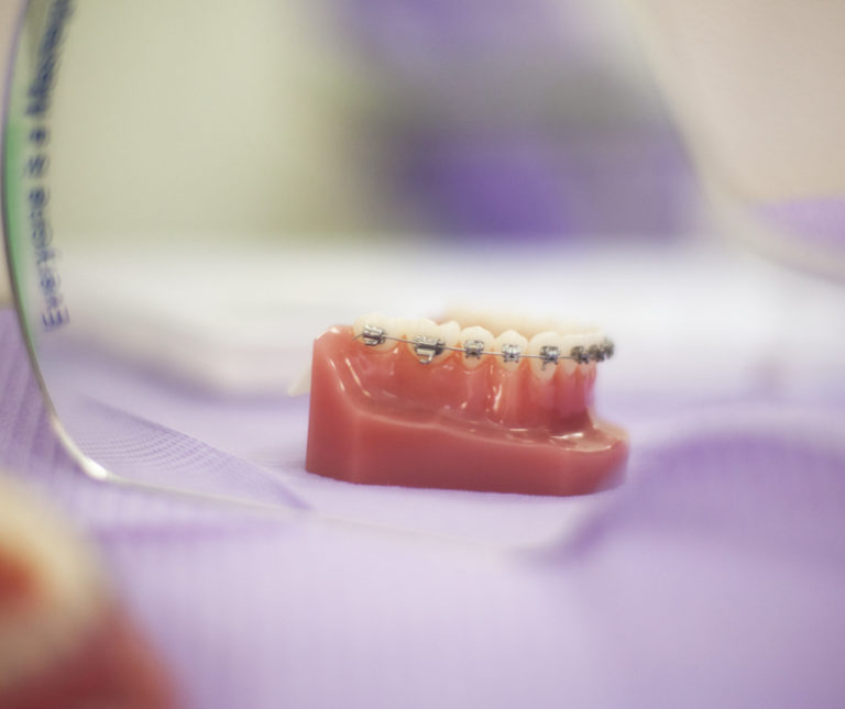 Agorà Medi | Trattamento Ortodonzia, apparecchio dentale a reggio emilia - ortodonzia a Reggio Emilia
