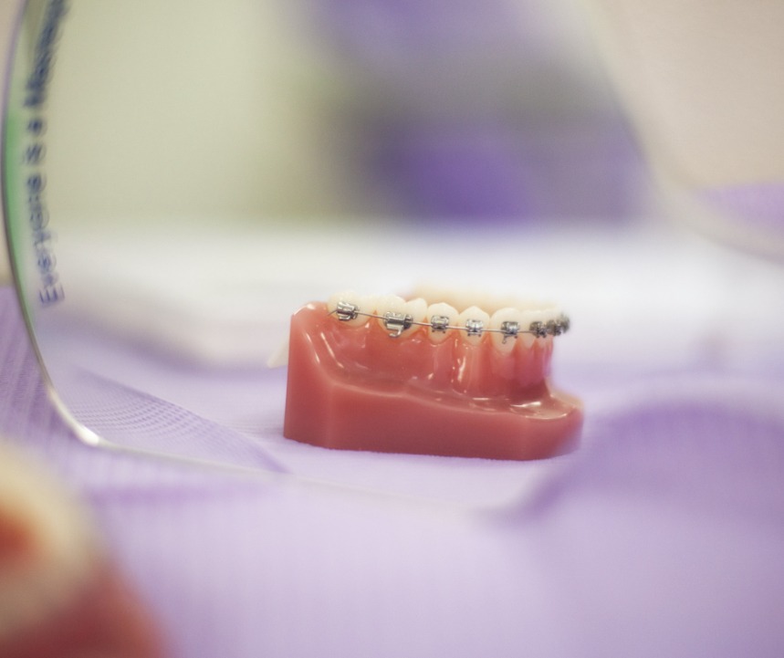 Agorà Medi | Trattamento Ortodonzia, apparecchio dentale a reggio emilia - ortodonzia a Reggio Emilia