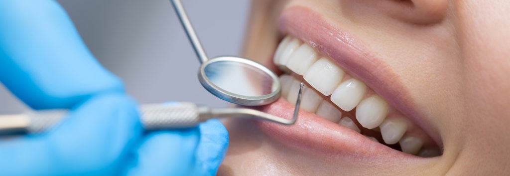 devitalizzazione dente a Reggio Emilia