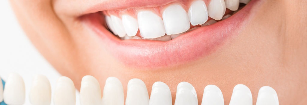 Agorà Medi | Slider Odontoiatria Estetica, faccette dentali a reggio emilia