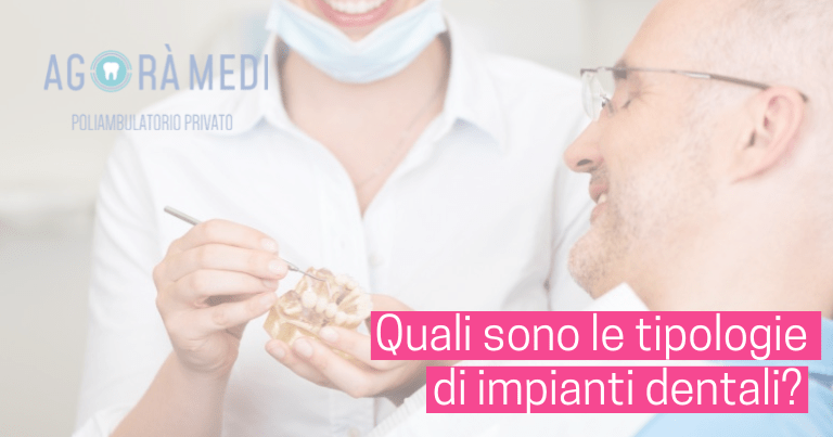 Agorà Medi - quali sono le tipologie di impianti