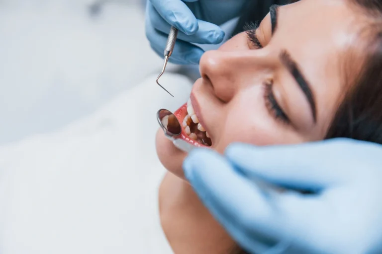 Differenza tra sbiancamento dentale e pulizia - glossario