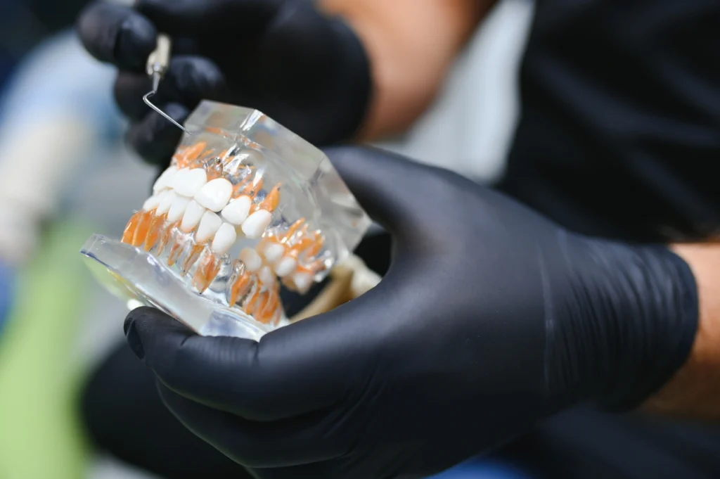 Differenza tra protesi mobile e impianto dentale