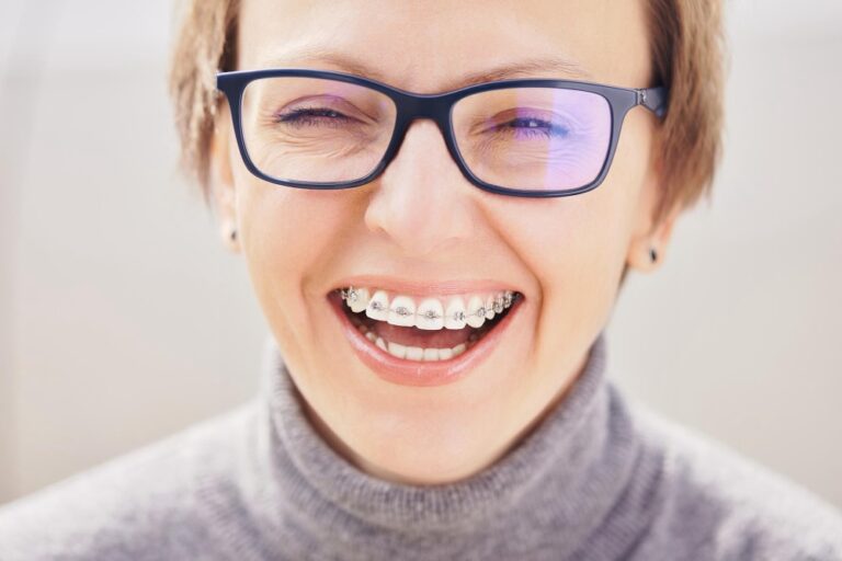 faq apparecchio dentale a Reggio Emilia
