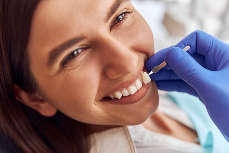 faq faccette dentali a Reggio Emilia